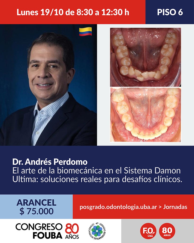 Perdomo